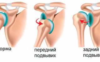 Конгруэнтность суставов