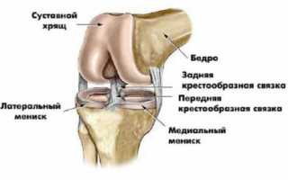 Как лечить перелом колена (коленного сустава) и сколько ходить в гипсе?