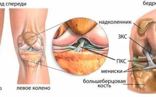 Что такое лигаментоз?